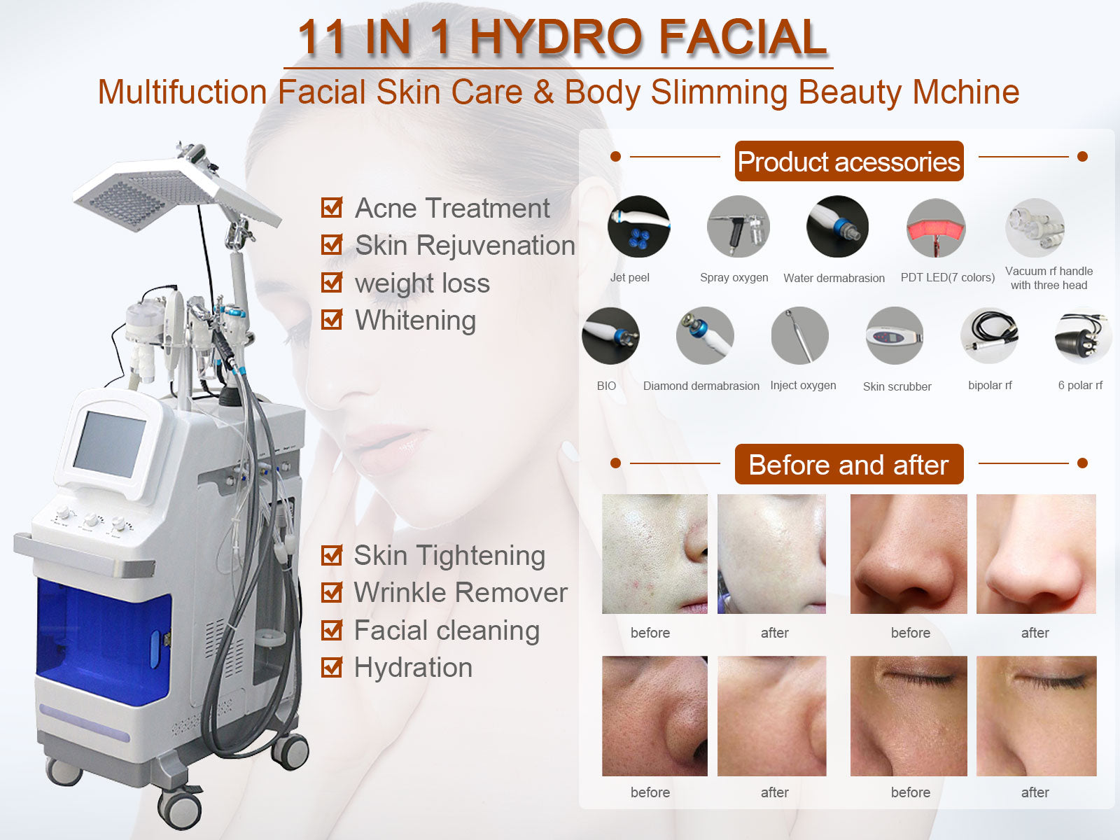 Professional 11-in-1 Hydro Facial Machine for Deep Cleansing & Skin Rejuvenation