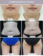 Professional 360° Cryotherapy Fat Freezing Machine for Non-Invasive Fat Reduction & Body Contouring