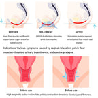 Professional Portable EMS + RF Pelvic Floor Muscle Stimulator for Pelvic Health & Body Toning