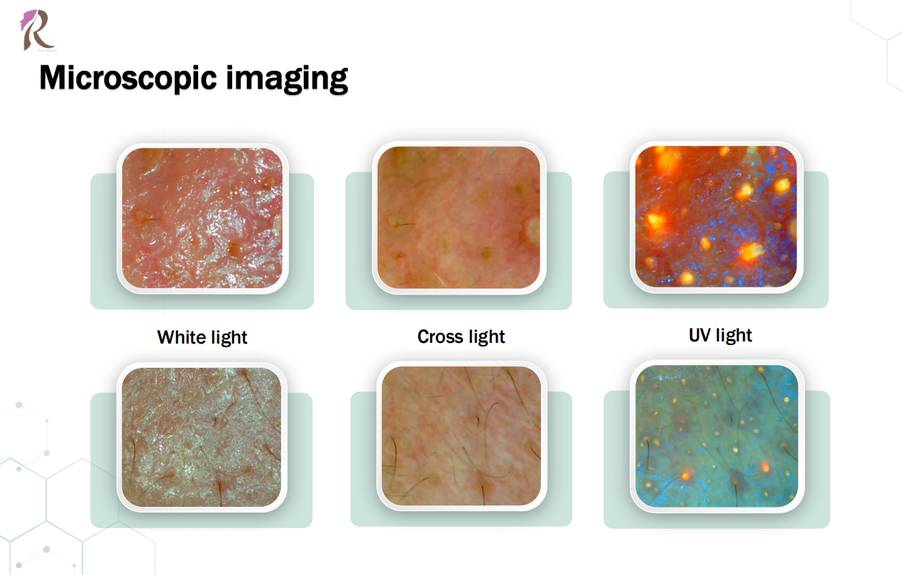 AI Skin Image Visualiser for Medical and Beauty Clinics and Dermatologists
