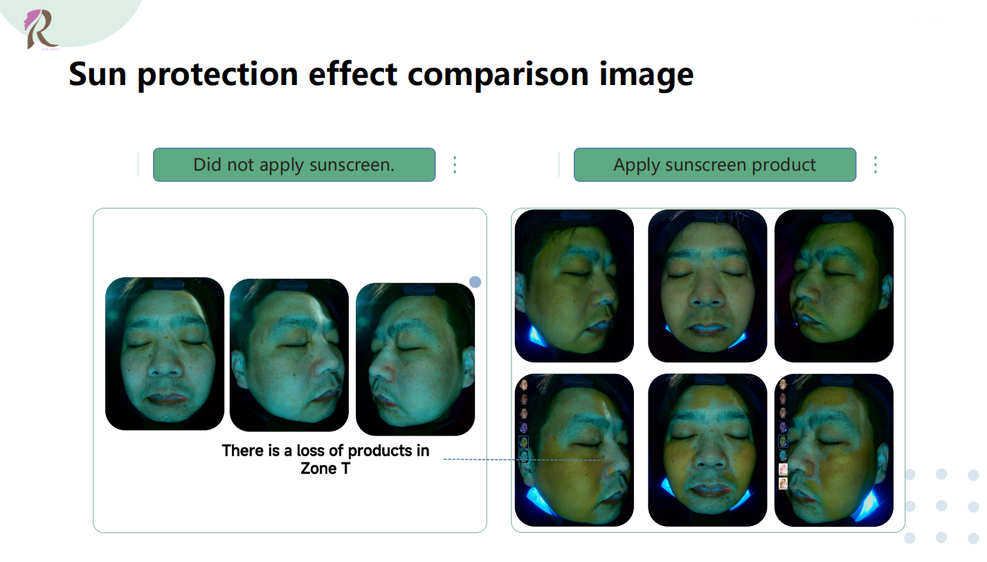 AI Skin Image Visualiser for Medical and Beauty Clinics and Dermatologists
