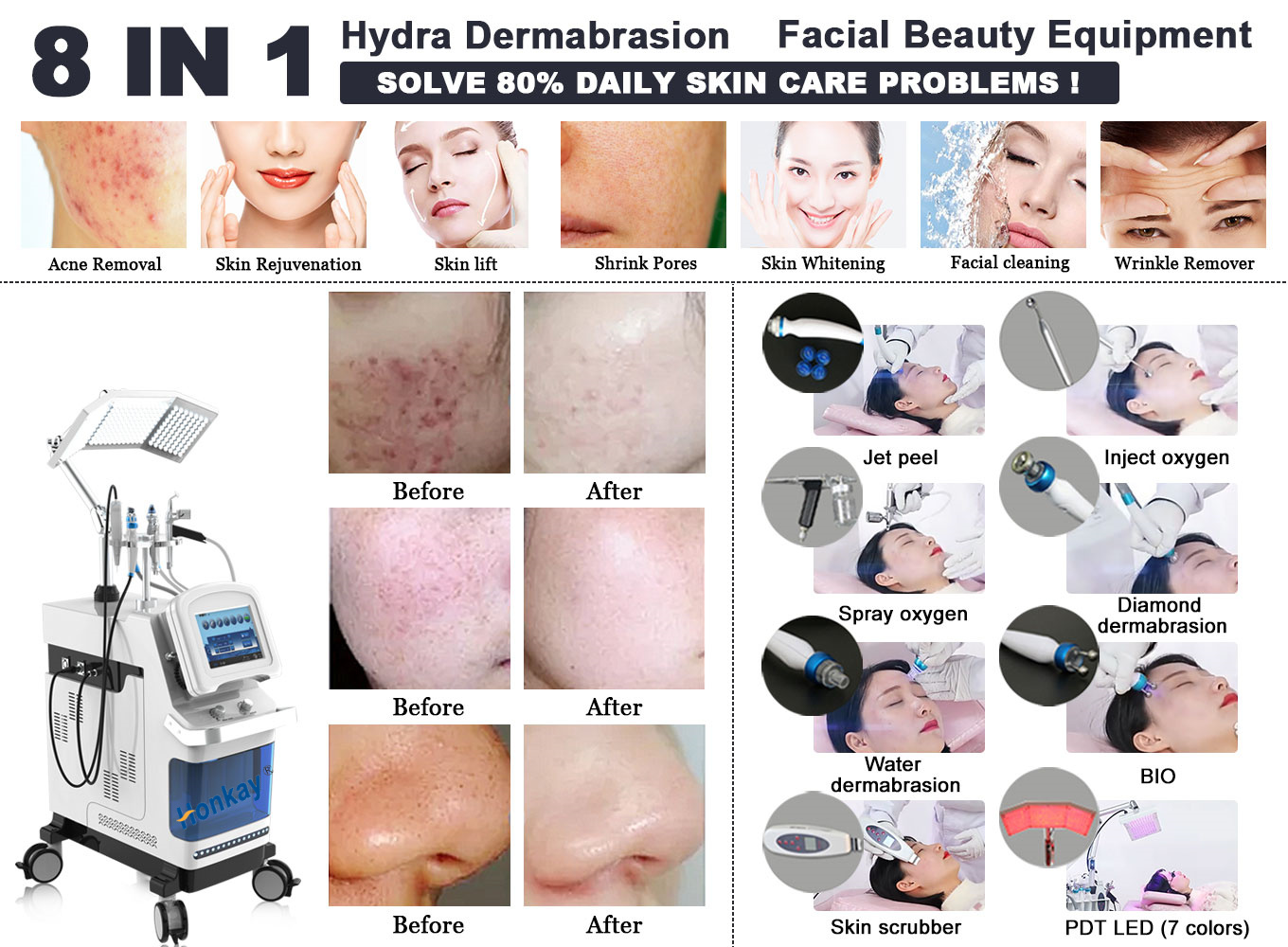 Professional 11-in-1 Hydro Facial Machine for Deep Cleansing & Skin Rejuvenation
