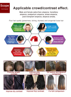 Professional 650nm Laser Hair Regrowth Machine for Hair Loss Treatment & Scalp Health