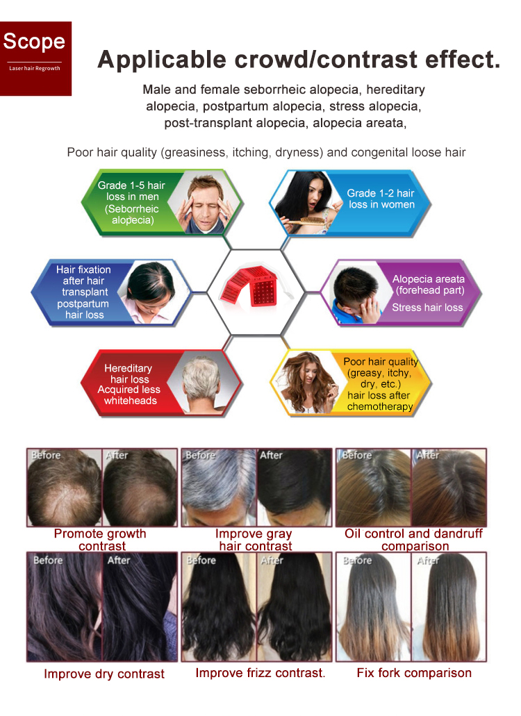 Professional 650nm Laser Hair Regrowth Machine for Hair Loss Treatment & Scalp Health