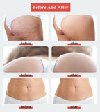 Professional Compressive Microvibration Therapy Machine for Cellulite Reduction & Body Contouring