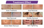 Professional 10600nm Fractional CO2 Laser Machine for Skin Resurfacing & Scar Removal