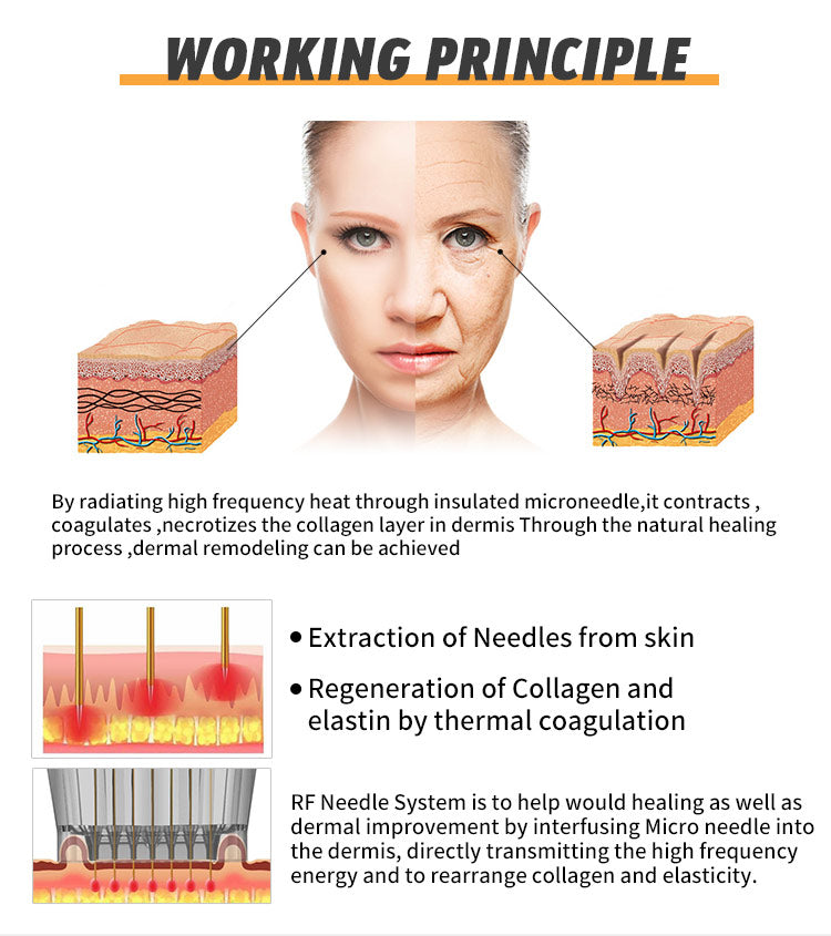 Professional 3-in-1 Fractional RF Microneedling Machine for Skin Rejuvenation & Scar Treatment