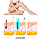 Handheld Ice Cooling ILP Hair Removal Laser
